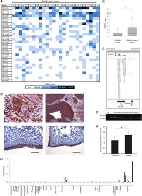 Characterization of the Olfactory Receptor OR10H1 in Human Urinary Bladder Cancer